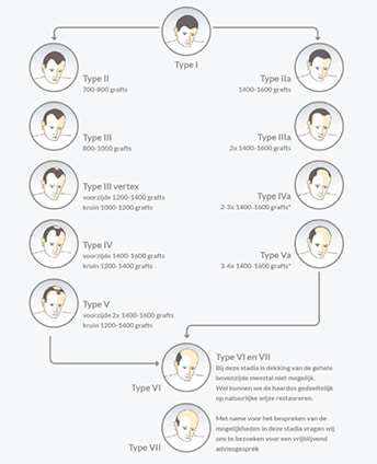 Types kaalheid haartransplantatie