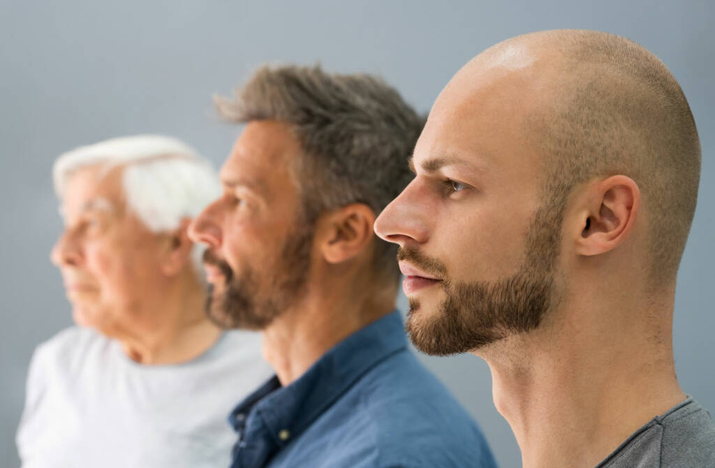 La greffe de barbe s’adresse principalement aux hommes